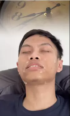 trik hilangkan jerawat ala rekomendasi dokter berbagai sumber