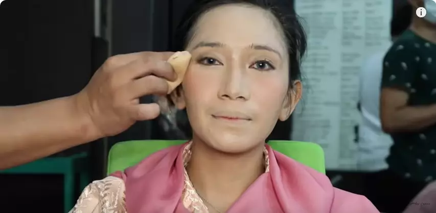 wajah penuh jerawat wisuda berbagai sumber