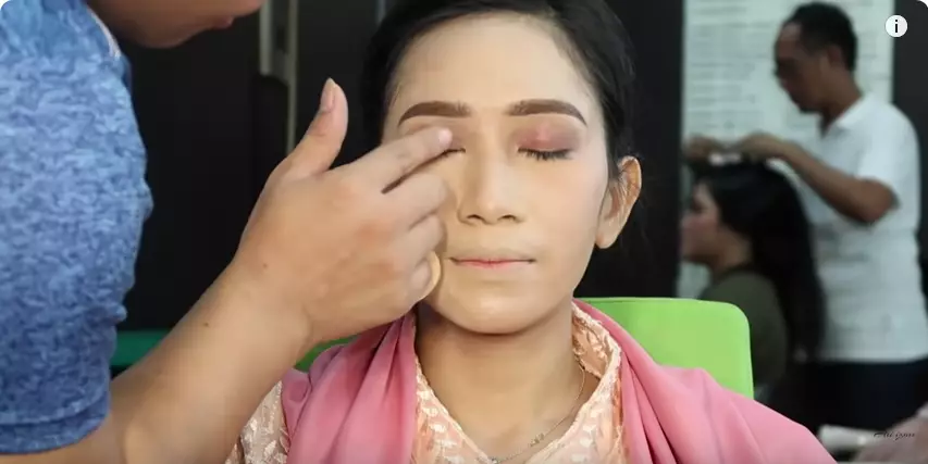 wajah penuh jerawat wisuda berbagai sumber