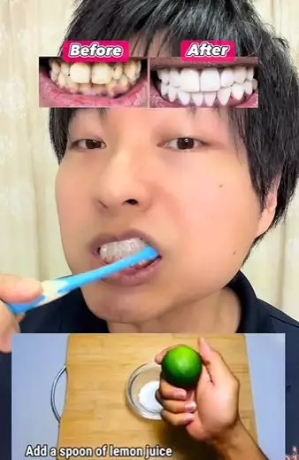 Pria atasi gigi tampak menguning pakai 2 bahan TikTok