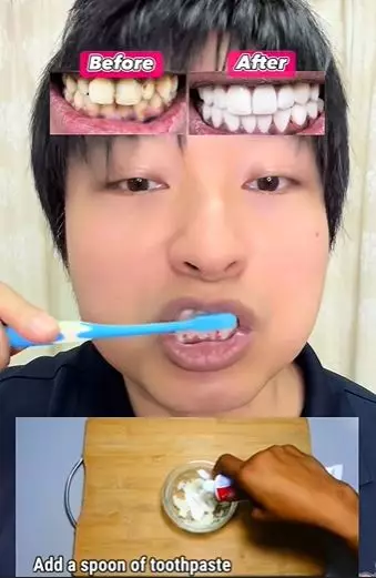 Pria atasi gigi tampak menguning pakai 2 bahan TikTok