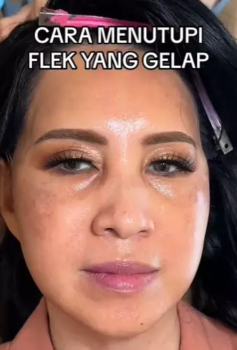 Ibu-ibu flek hitam lebih muda TikTok