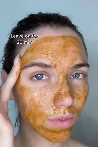 Atasi jerawat meradang tanpa acne patch TikTok