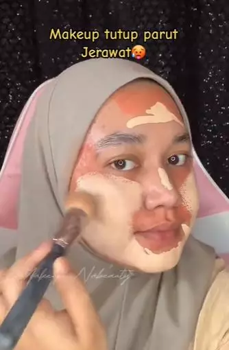 Cewek berjerawat makeup simpel melongo TikTok Cewek berjerawat makeup simpel melongo TikTok