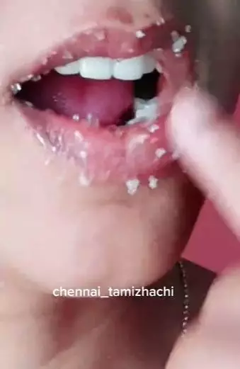 Gula pasir dan lemon atasi bibir hitam dan kering TikTok Gula pasir dan lemon atasi bibir hitam dan kering TikTok