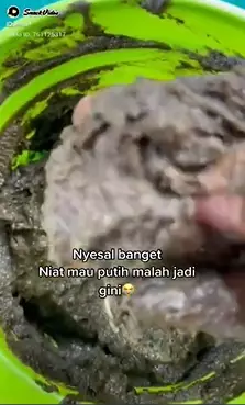 cara cerahkan bekas luka menghitam pakai jeruk berbagai sumber cara cerahkan bekas luka menghitam pakai jeruk berbagai sumber