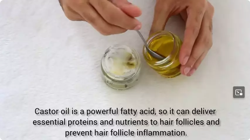 trik atasi rambut botak depan. berbagai sumber