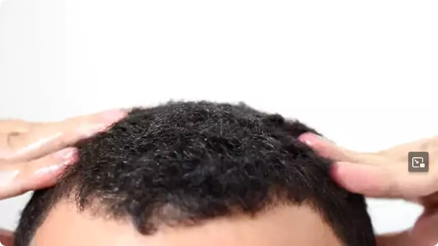 trik atasi rambut botak depan. berbagai sumber