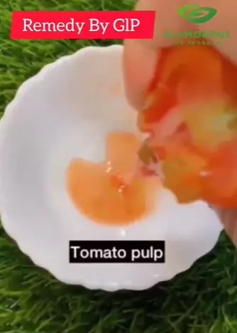 Atasi wajah kusam jadi auto cerah merata Berbagai sumber