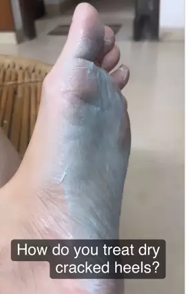 wanita ini bagikan cara atasi telapak kaki kasar berbagai sumber wanita ini bagikan cara atasi telapak kaki kasar berbagai sumber