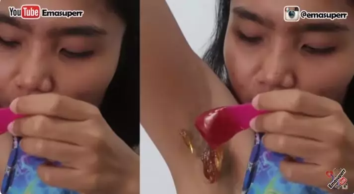 dokter ini bagikan cara hilangkan bulu ketiak berbagai sumber