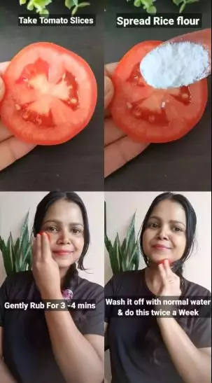 Atasi wajah berdaki kusam Berbagai sumber Atasi wajah berdaki kusam Berbagai sumber