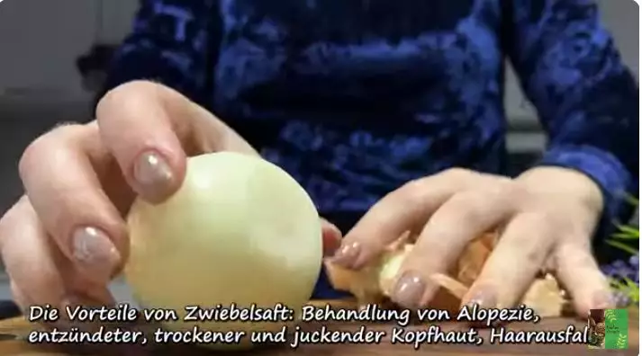 mengatasi rambut botak depan pakai beras berbagai sumber