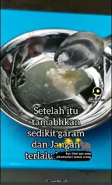 cara bersihkan karang & gigi kuning berbagai sumber cara bersihkan karang & gigi kuning berbagai sumber