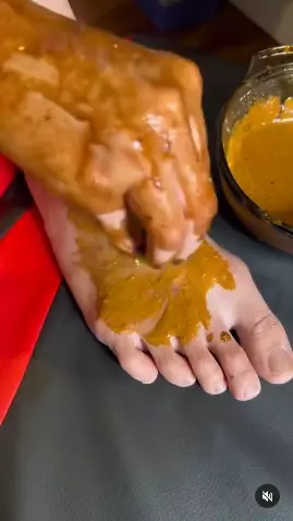 wanita ini bagikan cara atasi kulit kaki belang berbagai sumber