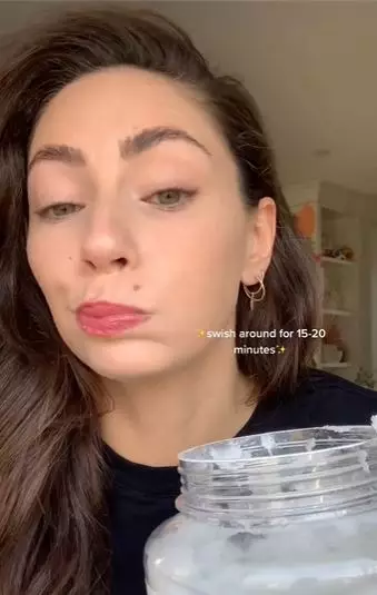 VCO atasi gigi kuning berkarang TikTok VCO atasi gigi kuning berkarang TikTok