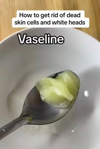 Bersihkan kotoran penyebab komedo putih Berbagai sumber