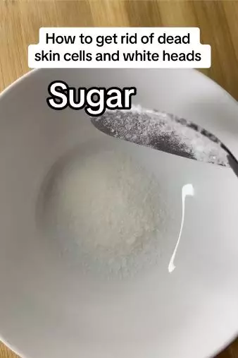 Bersihkan kotoran penyebab komedo putih Berbagai sumber