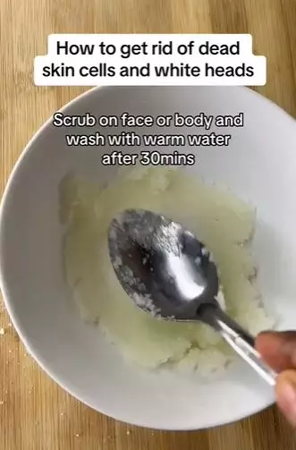 Bersihkan kotoran penyebab komedo putih Berbagai sumber