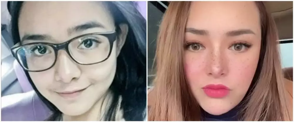 Amanda Manopo sebelum sesudah perawatan © berbagai sumber