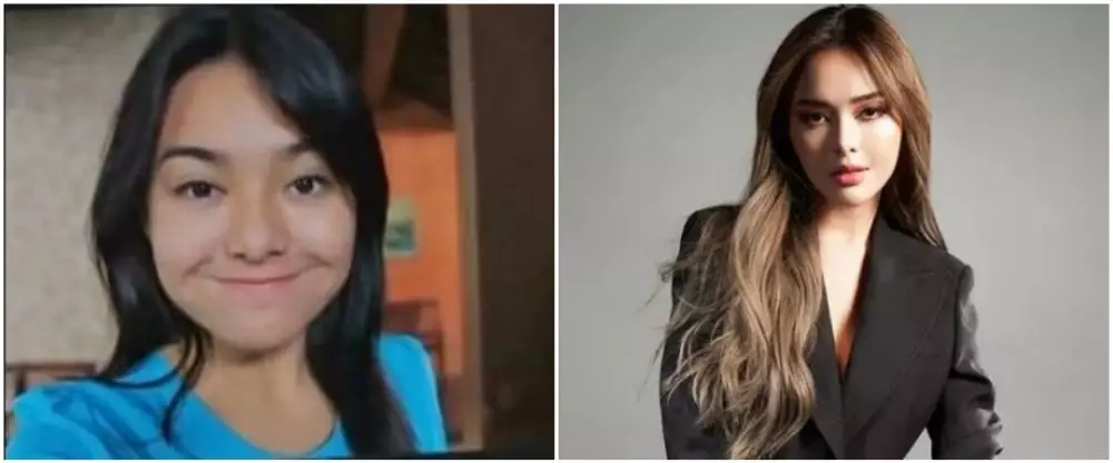 Amanda Manopo sebelum sesudah perawatan © berbagai sumber