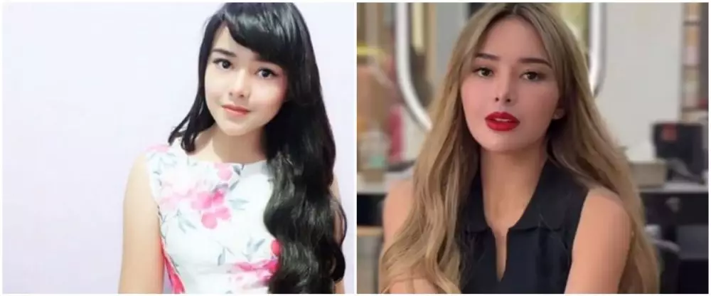 Amanda Manopo sebelum sesudah perawatan © berbagai sumber