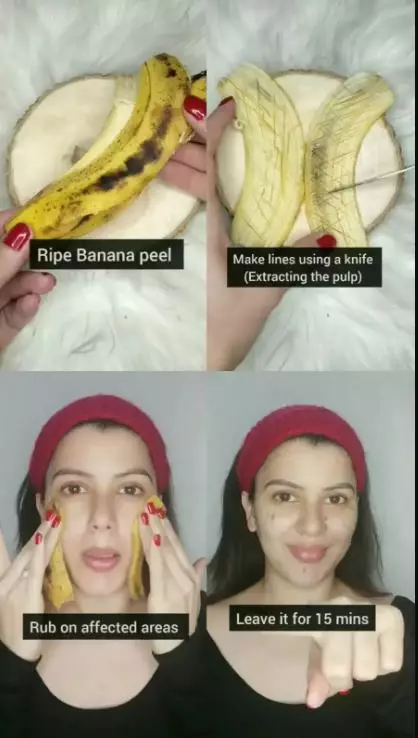 cara mengecilkan pori-pori di wajah berbagai sumber cara mengecilkan pori-pori di wajah berbagai sumber