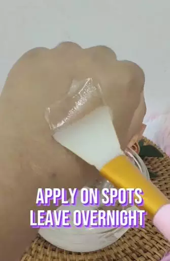 Atasi flek hitam di wajah vitamin E aloe vera Berbagai sumber