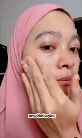 beauty vlogger bagikan cara pudarkan flek hitam berbagai sumber