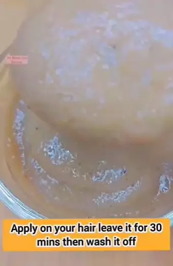 Tumbuhkan rambut botak tanpa tonic rosemary Berbagai sumber Tumbuhkan rambut botak tanpa tonic rosemary Berbagai sumber