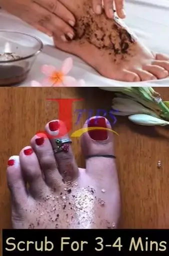 3 Bahan alami atasi kaki belang berdaki TikTok 3 Bahan alami atasi kaki belang berdaki TikTok