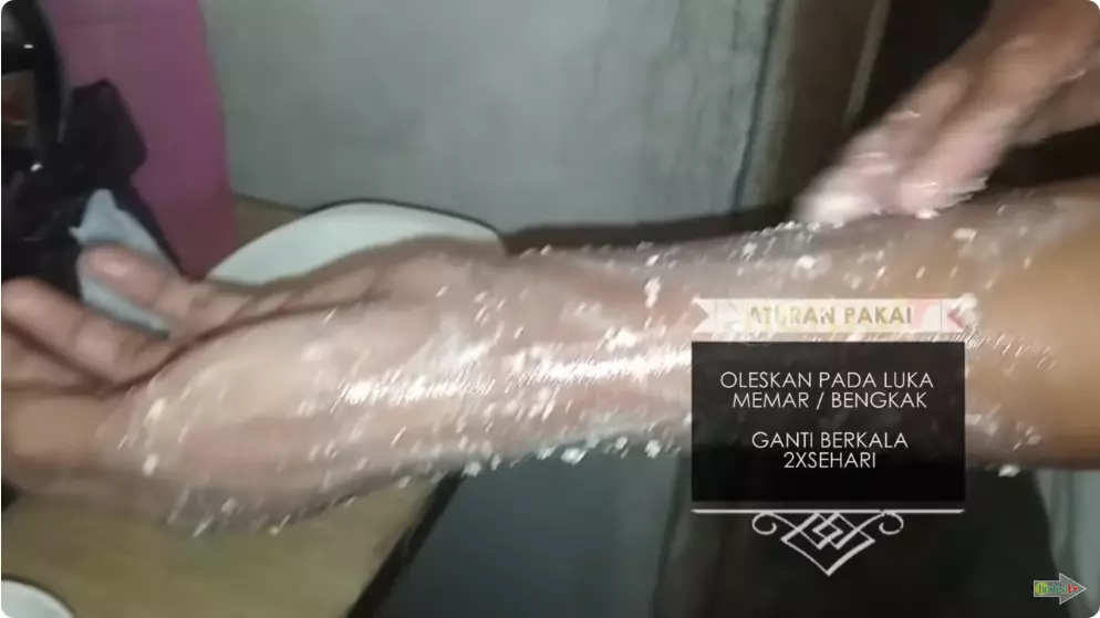 cara redakan memar membiru di kulit tangan berbagai sumber