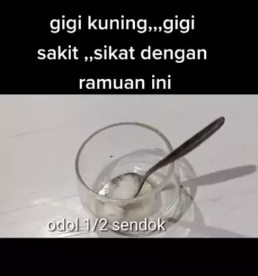 atasi gigi kuning ala YouTuber berbagai sumber atasi gigi kuning ala YouTuber berbagai sumber