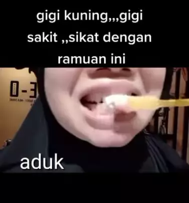 atasi gigi kuning ala YouTuber berbagai sumber atasi gigi kuning ala YouTuber berbagai sumber