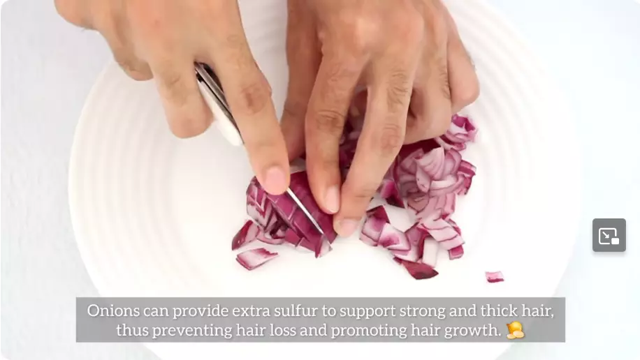 rambut rontok tumbuh dalam 10 hari. berbagai sumber rambut rontok tumbuh dalam 10 hari. berbagai sumber