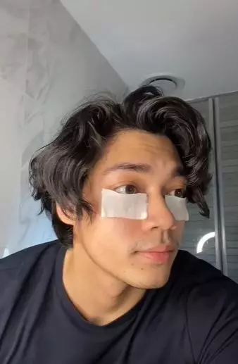 Pudarkan mata panda pakai hydrating toner dan serum pencerah TikTok Pudarkan mata panda pakai hydrating toner dan serum pencerah TikTok