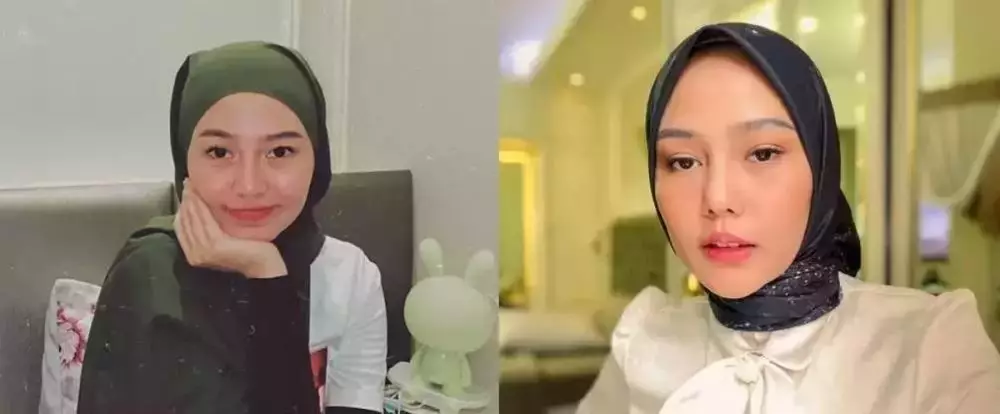 Seleb pilih oplas meski sudah cantik alami Berbagai sumber Seleb pilih oplas meski sudah cantik alami Berbagai sumber