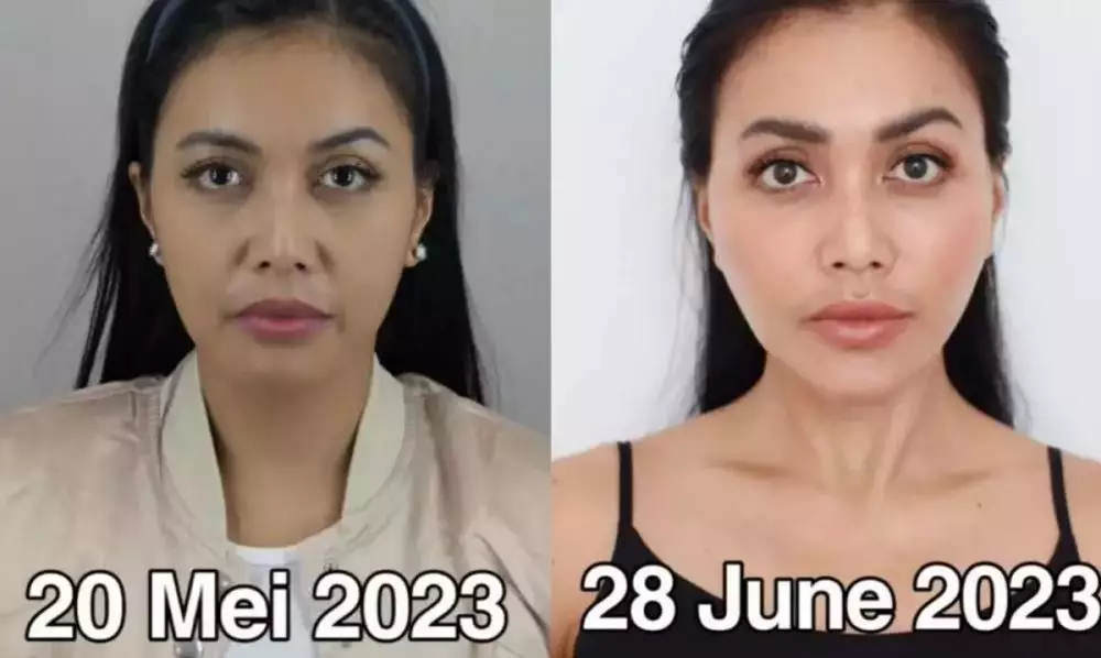 Seleb pilih oplas meski sudah cantik alami Berbagai sumber Seleb pilih oplas meski sudah cantik alami Berbagai sumber