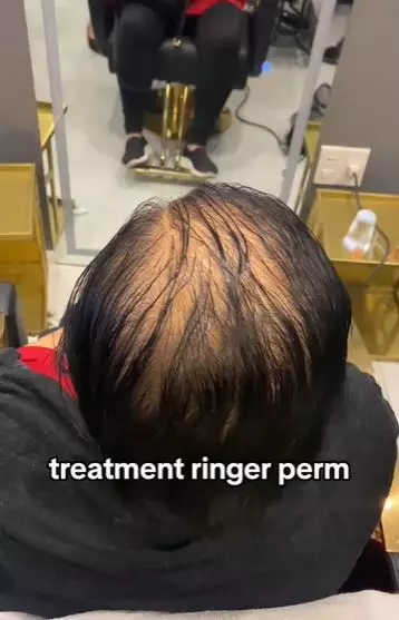 Perubahan emak-emak rambut super tipis akibat rontok usai di styling TikTok Perubahan emak-emak rambut super tipis akibat rontok usai di styling TikTok