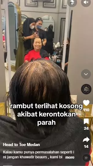 Perubahan emak-emak rambut super tipis akibat rontok usai di styling TikTok Perubahan emak-emak rambut super tipis akibat rontok usai di styling TikTok