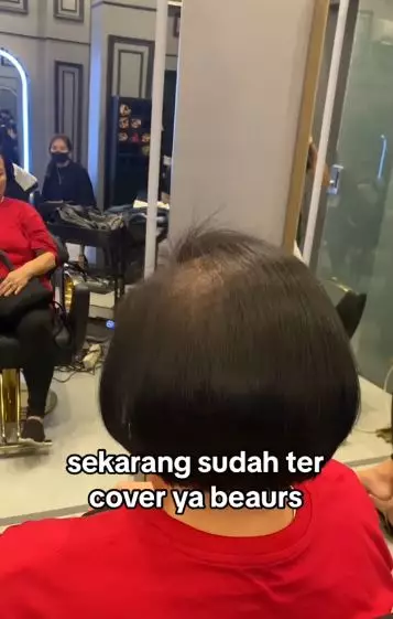 Perubahan emak-emak rambut super tipis akibat rontok usai di styling TikTok Perubahan emak-emak rambut super tipis akibat rontok usai di styling TikTok