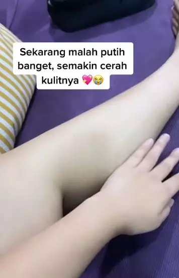 Perubahan kulit cewek usai minum kolagen yang menyebabkan breakout  TikTok