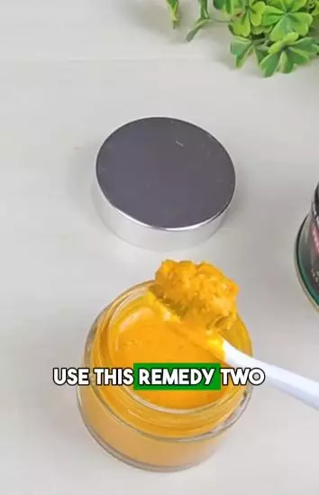 Kulit pisang dicampur 2 bahan dapur bisa putihkan gigi kuning berkerak Berbagai sumber Kulit pisang dicampur 2 bahan dapur bisa putihkan gigi kuning berkerak Berbagai sumber