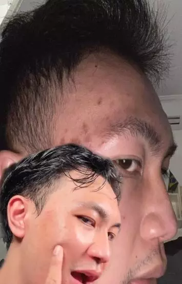 Review Skintific SYMWHITE377 Dark Spot Moisture Gel TikTok Review Skintific SYMWHITE377 Dark Spot Moisture Gel TikTok