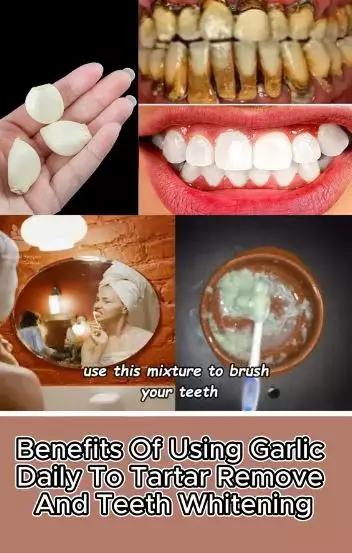 Bawang putih dicampur 1 jenis buah bisa atasi gigi bernoda kuning Berbagai sumber