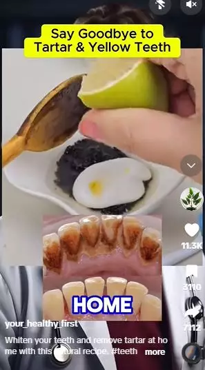 Pasta gigi dicampur 3 bahan dapur efektif bikin gigi kuning kembali putih Berbagai sumber Pasta gigi dicampur 3 bahan dapur efektif bikin gigi kuning kembali putih Berbagai sumber