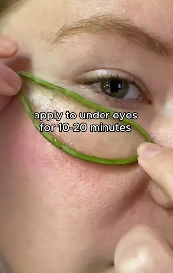 Satu jenis tanaman bisa atasi dark circle serta kerutan area mata Berbagai sumber Satu jenis tanaman bisa atasi dark circle serta kerutan area mata Berbagai sumber