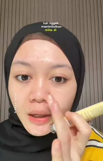 Review ST TREE 3D Massager Eye Cream TikTok Review ST TREE 3D Massager Eye Cream TikTok