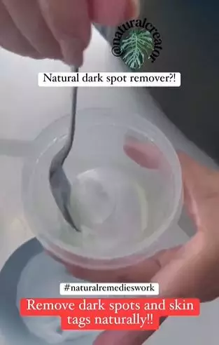 Kombinasi baking soda dan 1 jenis minyak ampuh pudarkan flek hitam di wajah Berbagai sumber