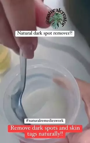 Kombinasi baking soda dan 1 jenis minyak ampuh pudarkan flek hitam di wajah Berbagai sumber